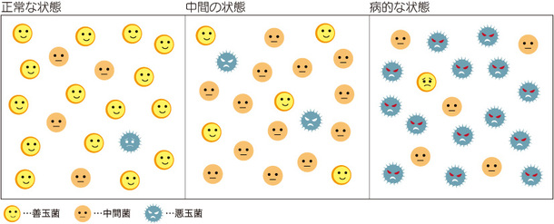 膣フローラと乳酸菌