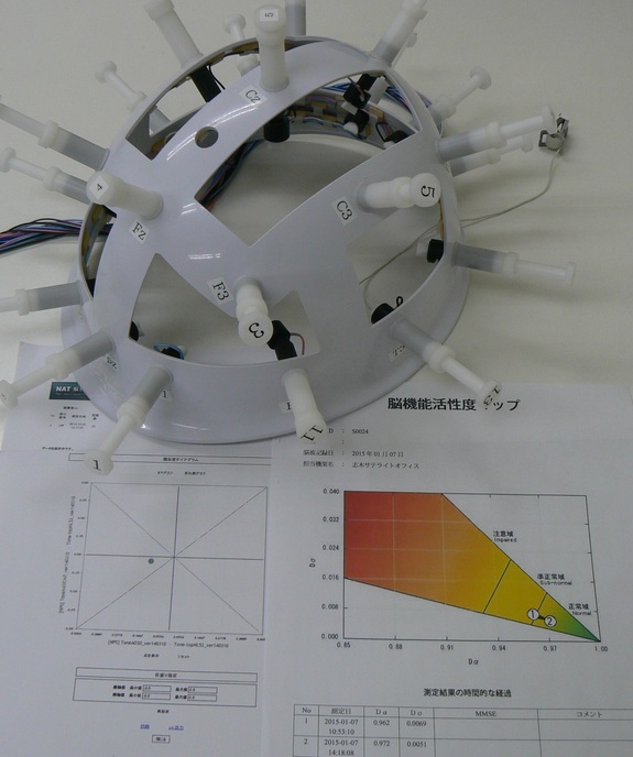 脳波測定器とその結果のイメージ